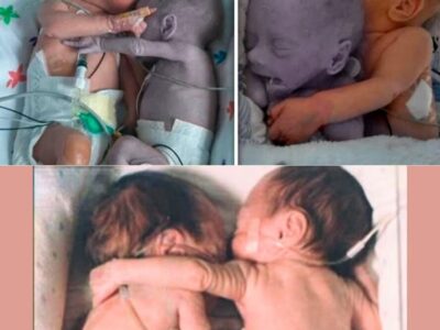 They placed a healthy baby next to its dying twin – what happened next is heartbreaking.