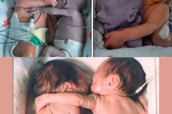 They placed a healthy baby next to its dying twin – what happened next is heartbreaking.