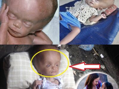 She Found This Abandoned Baby Laying In Trash. How She Rescued Her Filled My Eyes With Tears