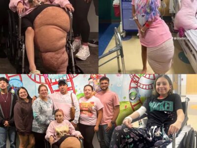 She Lived With a 174-Pound Leg—Then One Decision Changed Everything…
