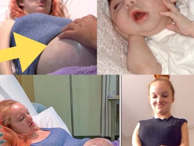 This Woman Was Born With Nearly No Body Muscle, But She Defied Doctors To Carry A Baby To Term