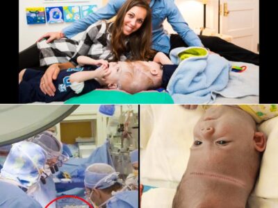 Doctors Risked Everything, Trying To Separate Them – What the Conjoined Twins Look Like After More Than 30 Hours of Surgery