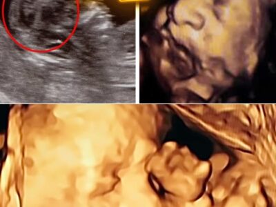 DAD SEES BABY’S FACE IN ULTRASOUND AND FILES FOR DIVORCE