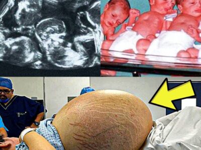 Doctor Tells Mom She’s Having Multiple Babies Before Revealing an Even Bigger Surprise
