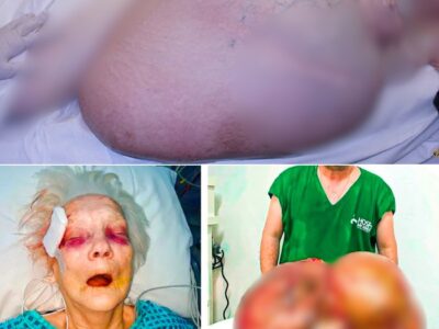 Elderly Woman Thinks She’s DYING, Then Doctor Reveals What They Found Inside …
