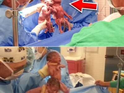 A Woman Gave Birth To Semi-Identical Twins, And Doctors Were Left Totally Perplexed