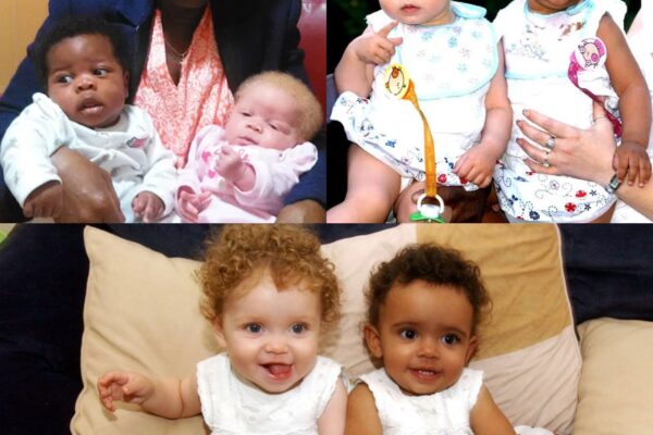 Mom’s Twins Are Different 25 Years Later, They’re Unrecognizable