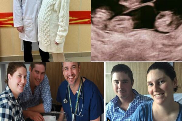 It Happens Once In 48 Million Births! She Is The Little Girl Who Impressed Doctors.