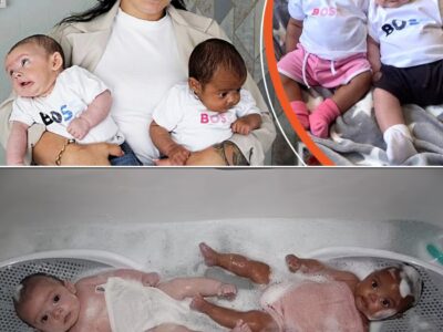 White Mom Gave Birth to Twins with Different Skin Colors – People Say She Needs to Do a Dna Test