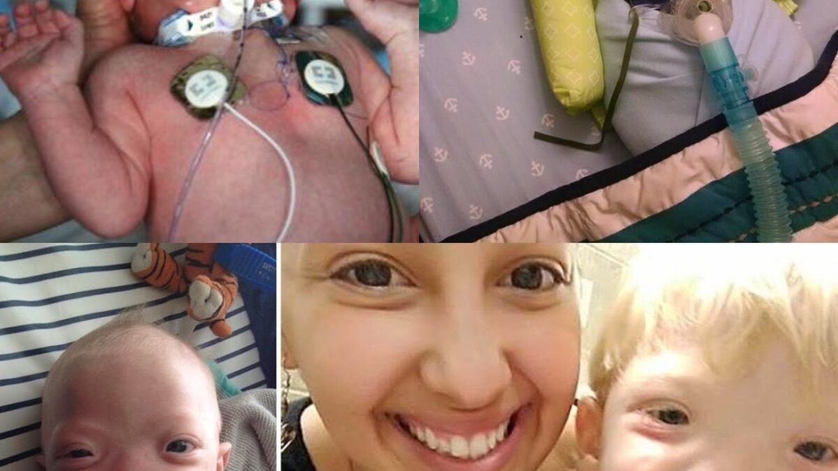 Miracle Baby Born Without a Nose Dies at Age 2—His Final Words Leave Everyone in Tears