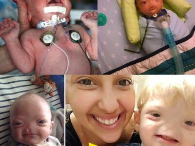 Miracle Baby Born Without a Nose Dies at Age 2—His Final Words Leave Everyone in Tears