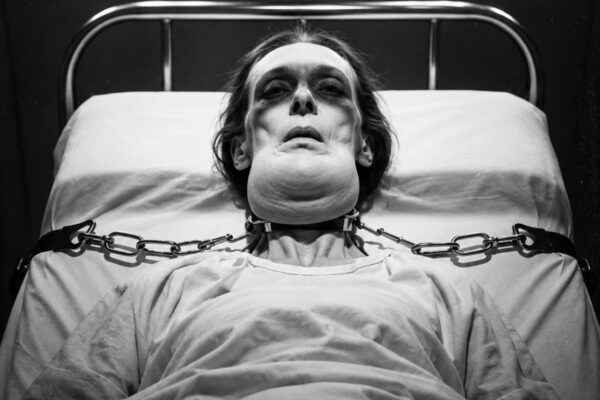 The Porcelain Wife Nightmare – Husband Removed Her Teeth to Keep Her Perfect (1888)