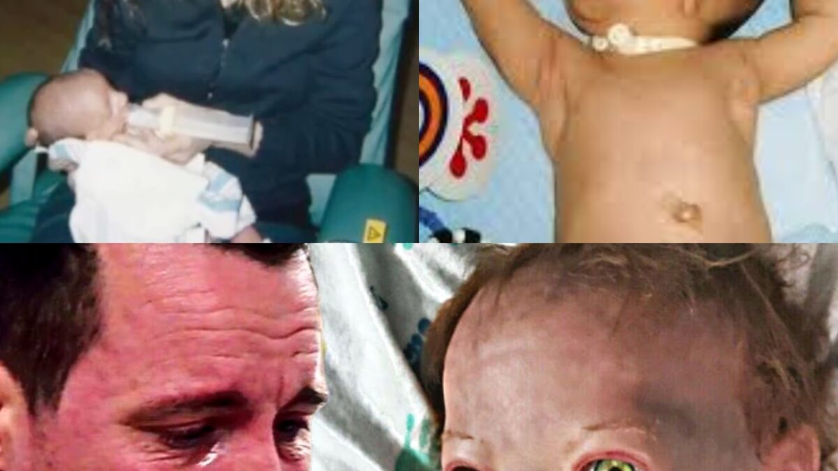 Mom Gave Birth To MONSTER, When Dad Saw Him He Was Horrified, What HAPPENED LATER IS MORE SHOCKING