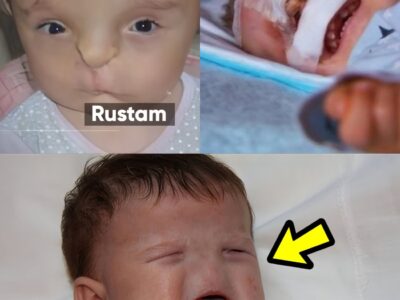 Boy Born Without A Leg, Mouth And Nose. Here’s What It Looked Like 9 Years Later!